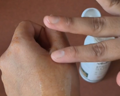 Apply PsoroSudha Oil